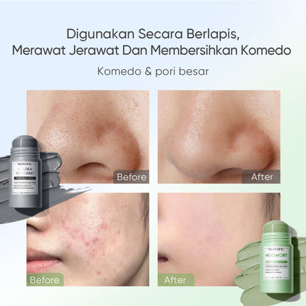 SKINTIFIC - Mugwort Acne Clay Stick + Alaska Clay Stick